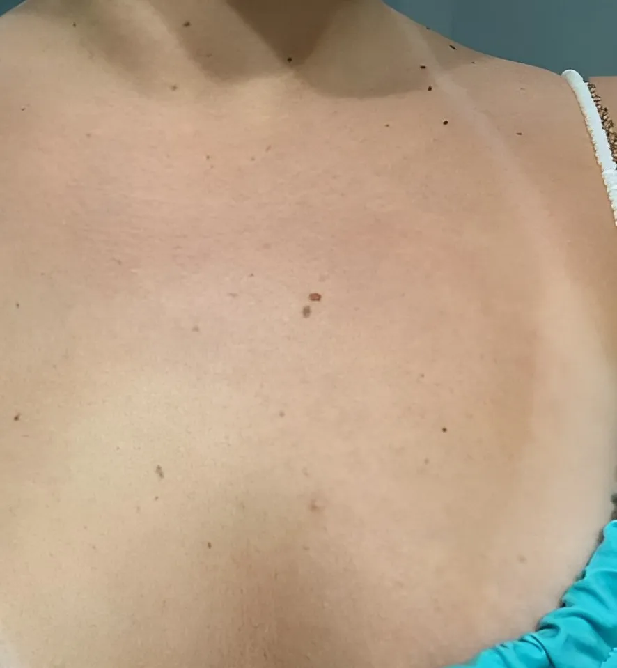 Décolleté de la même cliente, 12 heures
