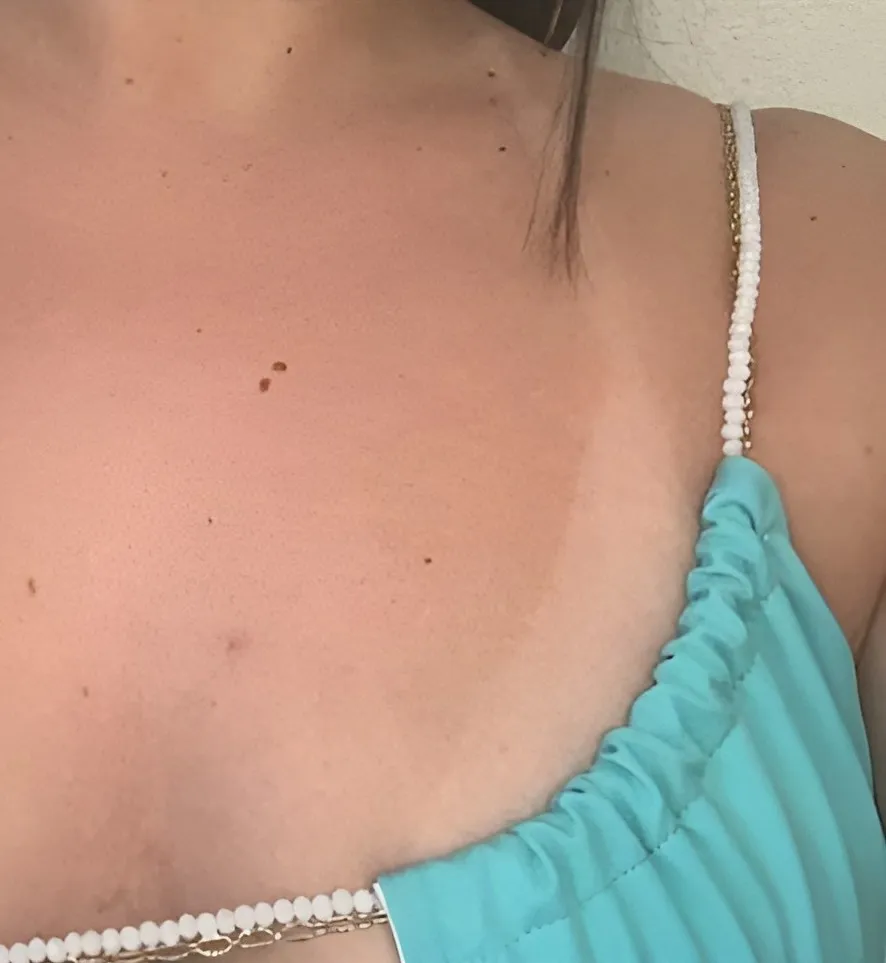 Décolleté de la même cliente, après rinçage