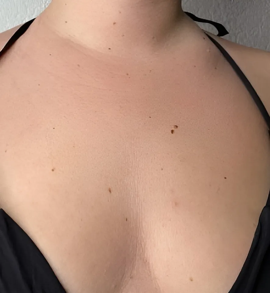 Décolleté de la même cliente, avant